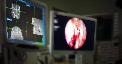 CT sinus