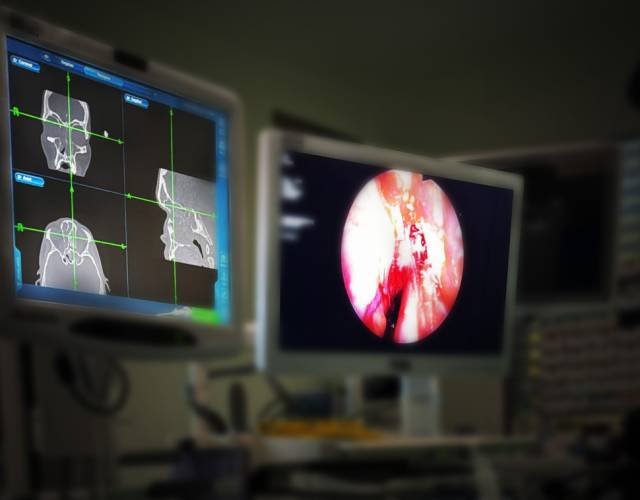 CT Sinus Module