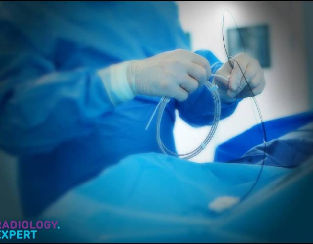 Interventional Radiology - Non-Oncological