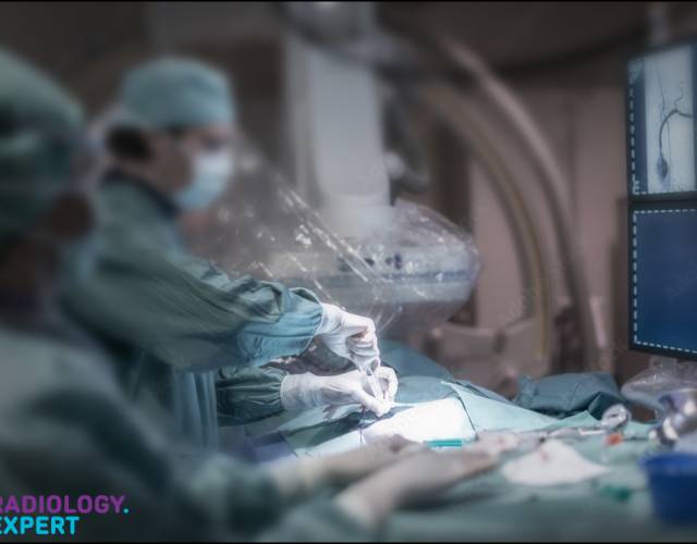 Interventional Radiology - General