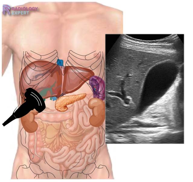 liver ultrasound anatomy