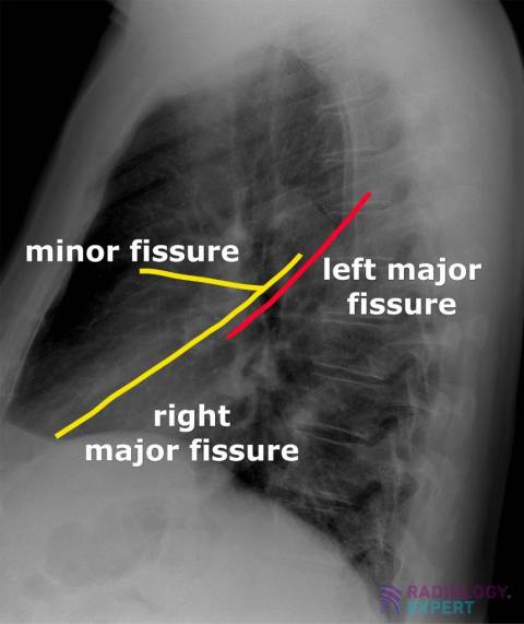 normal lateral chest xray